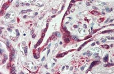 Immunohistochemistry-Paraffin: Embigin/EMB Antibody [NBP3-14307]